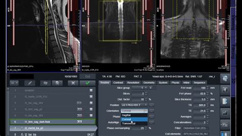 eprocess.cardmri.com